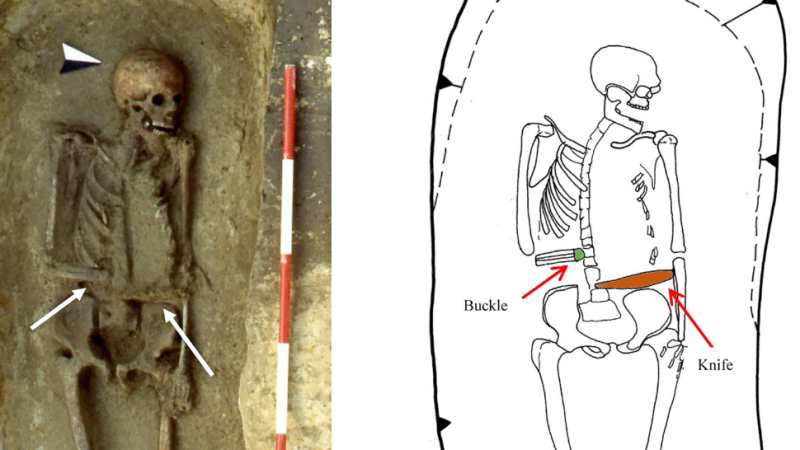 مرد ایتالیایی قرون وسطایی دست خود را با چاقو عوض کرده بود